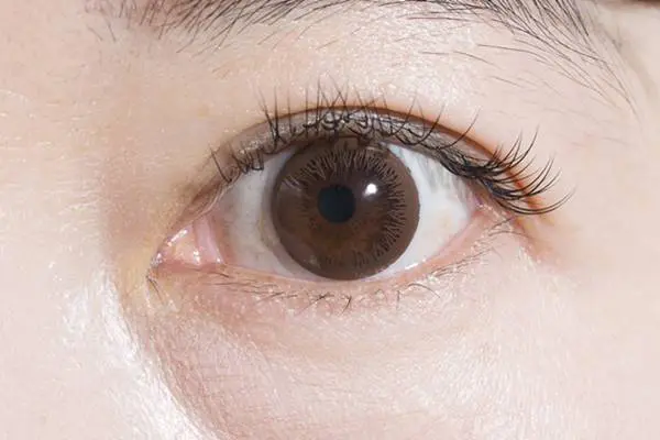 医師が教える 目 で知る病気のサイン 重病見抜くヒントにも 女性自身 医師が教える 目 で知る病気のサイン 重病見抜くヒントにも 女性自身