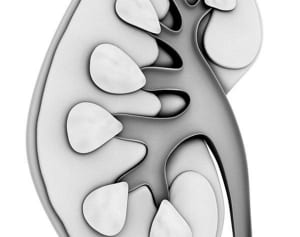 “沈黙の臓器”腎臓が発する小さなＳＯＳを見逃さないで
