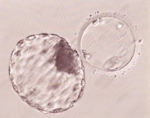 年々増加傾向…女性の未来サポート担う「卵子凍結」の実態