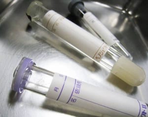 3カ月に1度は薬局へ…自分でできる“血液検査”のすすめ