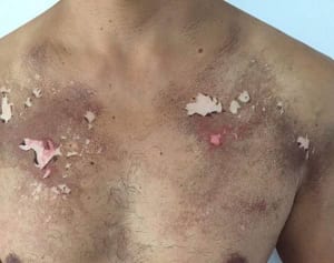 茅ケ崎のTシャツ炎症問題　業過傷害の疑いで製造者書類送検