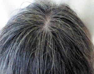 抜いちゃうのはNG！顔まわりの白髪は“冷え”が原因！