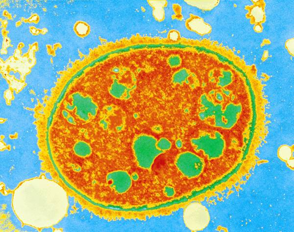 ビフィズス菌、R-1…腸によいという「乳酸菌」てそもそも何？