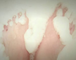 “ブーツのムレ”で「水虫」になったら使いたい専用石けんとは？