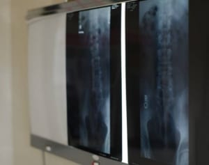 1カ月ぶんの便がレントゲンに…「便秘」患者語る原因と治療