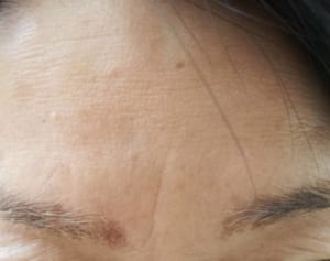 “眉間のシワ”は肝臓に危険信号？顔でわかる病気のサイン