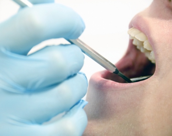 隙間から虫歯にも…歯周病も引き起こす“ズレた銀歯”の恐怖