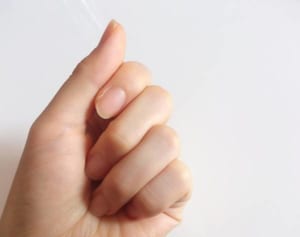 専門医が伝授！　ツメの色を見れば“病気の疑い”がわかる！
