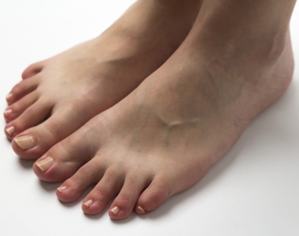 女性の8割抱える「足の浮き指」、不調招く可能性を医師が指摘