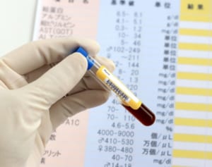 唾液や血液、尿でわかる！最新「お手軽がん検診」のお値段