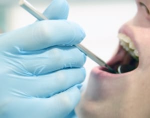 歯を抜きたがる医師にご用心！危ない歯科医には共通点が