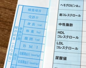 「健康診断正常値」国と医師ずれ…学会と製薬会社の癒着指摘