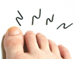 飲食店の座敷席でも…4種類あった「女性の水虫」ここでうつる