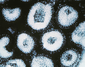 「紅茶」がインフルウイルスを撃退、成分が実験で示した効果