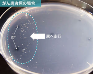 9800円で全身をがん検査、「線虫」が拓くがん早期発見の道