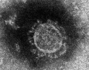 スペイン旅行から帰国の沖縄在住10代女性が感染　成田空港の検疫所で確認　無症状で「陽性」
