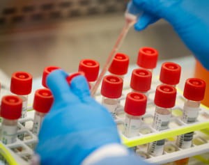 難病の基礎疾患持つ6歳児、新型コロナウイルスから回復を報告