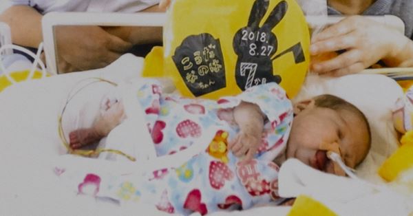 誕生直後に生存率30 の 余命宣告 325gの娘が生きた9カ月 女性自身