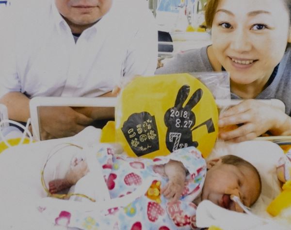 誕生直後に生存率30％の“余命宣告”…325gの娘が生きた9カ月