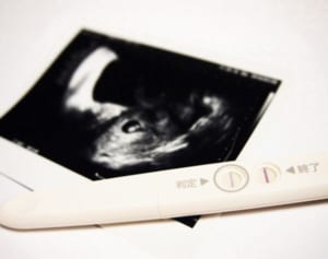 不妊治療保険適用で“手抜き診療”増える？専門家が解説