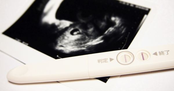 不妊治療保険適用で 手抜き診療 増える 専門家が解説 女性自身