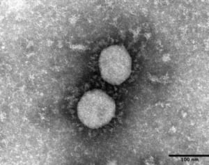 デルタ株、沖縄で初確認　2人が入院、感染力強く（6月25日朝）