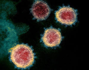 「2週間休校必要」　コロナ県専門家会議　新たに297人感染（6月3日朝）