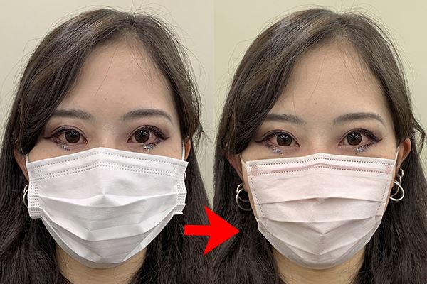 DAISOマスクの小顔効果がすごすぎる！盛れるマスク選びのポイントを解説