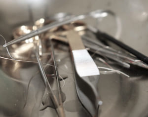 摘出した筋腫をバックにポーズをとった女性外科医がインスタで炎上