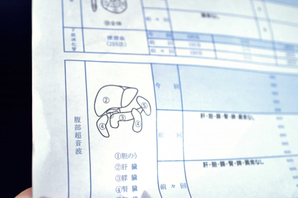 肝硬変や肝炎発症のリスクあり!成人の3分の1が「脂肪肝」持ちの日本人