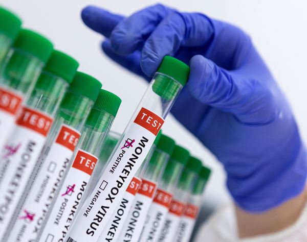 新型コロナ、サル痘、HIVすべて陽性…「三重感染」が世界で初確認