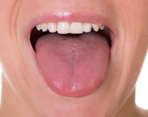 1日3分舌はがし　口呼吸改善で頭痛不眠たるみも解消