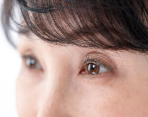 顔の彫が浅い人は要注意！「眼の日焼け」が白内障やシミの原因に