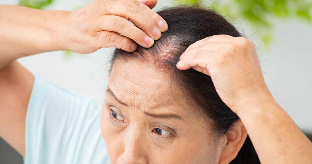 白髪、薄毛、うねり……女性の髪トラブルを美髪に復活させる若返りホルモン『マイオカイン』って？