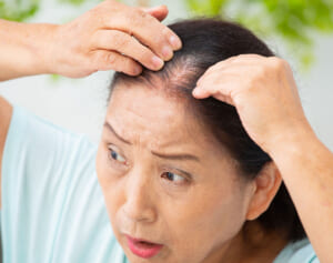 白髪、薄毛、うねり……女性の髪トラブルを美髪に復活させる若返りホルモン『マイオカイン』って？