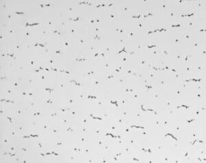 「虫みたい」とSNSで話題の病院の天井、なぜこの柄？建材会社が明かした“メリット”