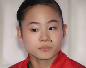 「私も取りました」元体操女子日本代表の“激変”ビジュが話題、共感を呼んだ“手術”