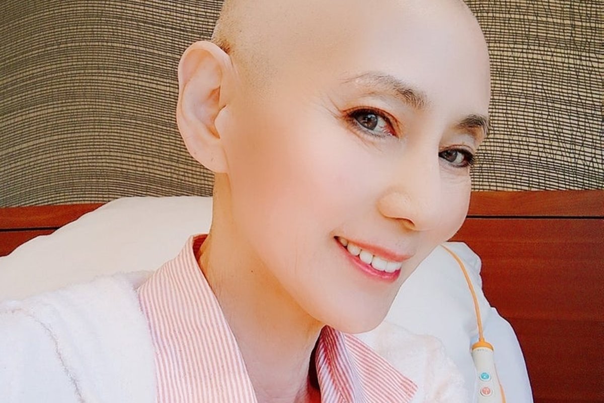 食道がんの5年生存率(病期別)