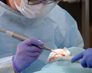 《顎の骨が砕けた人も》インプラント治療トラブルが急増中…危ないクリニックの「共通点」