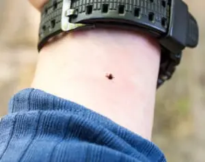 致死率は10～30％、全国に拡大…“マダニ感染症”の「簡単な見分け方」と身を守る服装