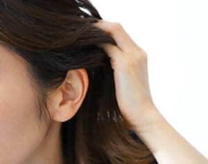 「薄毛の対策」“お金をかけずにできる！髪を増やす方法5選”医師に聞いてみたら…