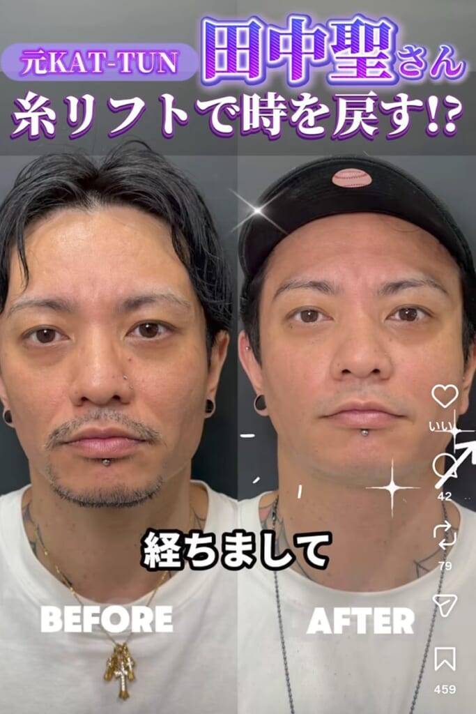 《“局部にシリコン”3つ》消えた元“旧ジャニ”　6度の逮捕→出所後は“予測不能”な活動→美容整形の“症例モデル”→今度は“身体の一部”にジュエリー