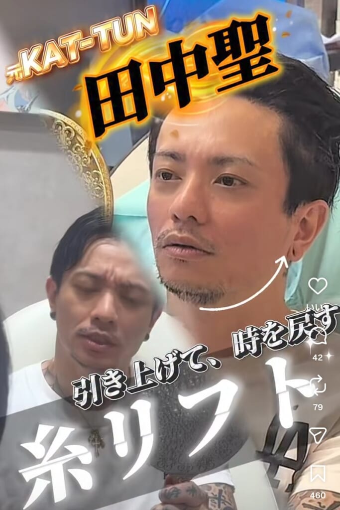 《“局部にシリコン”3つ》消えた元“旧ジャニ”　6度の逮捕→出所後は“予測不能”な活動→美容整形の“症例モデル”→今度は“身体の一部”にジュエリー