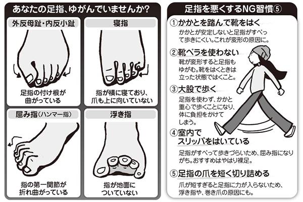 あなたの足指は大丈夫 日本人が起こしやすい足指の変形症状 女性自身
